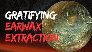 The MOST GRATIFYING Earwax Extraction EVER !!!