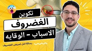 اسباب انزلاق الغضروف و طريقه الوقايه