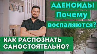 Аденоиды. Когда и почему воспаляются. Узнайте, когда аденоиды перестают расти.