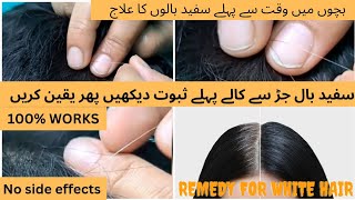 Remedy for White Hair in Kids||سفید بال جڑ سے کالے|| How to Cure Premature Grey Hair