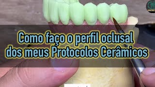 Como faço o perfil oclusal dos meus Protocolos Cerâmicos