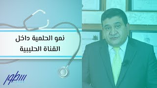 نمو الحلمية داخل القناة الحليبية