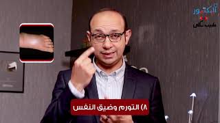 ما هي علامات وجود مرض في الكلى وكيف أتصرف إذا كان عندي أي علامة منهم؟