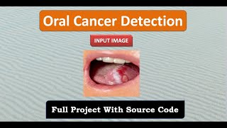 Oral Cancer Detection Using Image Processing With Source Code | Oral Cancer Detection Using CNN