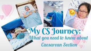 My CS Journey: How I ended up Caesarean Section and what you need to know about this procedure