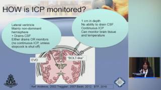 Mastering ICP Management