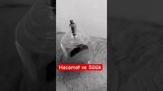 #hacamat #sülük #hijama #cupping #leech #getat