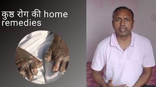 कुष्ठ रोग की home remedies