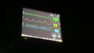 Ge bx50 patient monitor in the dark at night