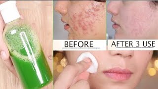 "Glowing Skin Ke Raaz: Viral Ho Rahi Hai Hamari Mint aur Camphor Face Toner DIY Recipe!"