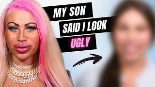 'Plastic Surgery Mom' Hates Dramatic New Look | TRANSFORMED