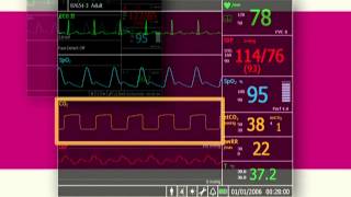 Device Overview VM Series