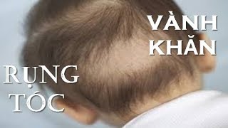 Giúp các mẹ hiểu: Tại sao con rụng tóc vành khăn và nó không liên quan đến thiếu Canxi