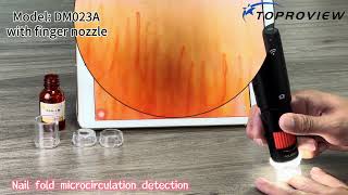 DM023A Nail Wall Microcirculation Detection