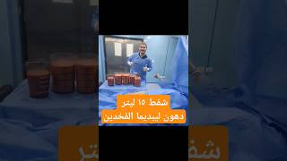 من ألمانيا 🇩🇪 شفط ١٥ ليتر من دهون الليبوديما فى الفخدين مع د محمد الهيتمى