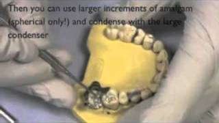 PRD complex amalgam part 2 of 3