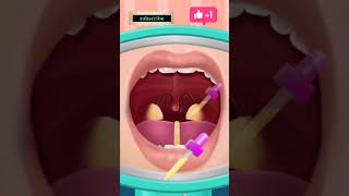 asmr animation surgery #shortfeed #shortvideo #asmr #asmrsurgery #short#shorts#youshorts