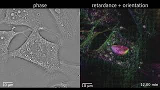 QLIPP of U2OS cell division