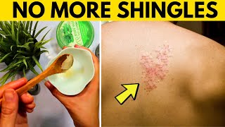 how to treat shingles, painful skin rash on your face quickly in 3 days