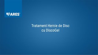 Tratament Hernie de Disc |  Spitalizare de 6 h | Recuperare ușoară | ARES