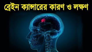 ব্রেইন ক্যান্সারের কারণ ও লক্ষণ