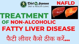 Dietary Modifications in Non-Alcoholic Fatty Liver Disease (NAFLD) - Pro Tips to Cure Fatty Liver