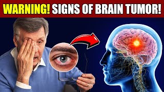 WARNING: 10 Brain Tumor Symptoms You Can't Ignore! | Dr. Smile