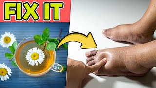 DRINK IT! Top 10 Best Herbal Teas That Soothe Swollen Ankles and Feet