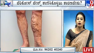 Nimma Doctor | Treatment For Varicose Veins | Namma Homeopathy (04-08-2023) | #TV9A