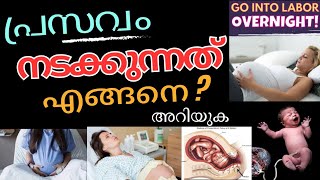 പ്രസവം എങ്ങനെയാ നടക്കുന്നത് അറിയുക/Labor room procedure | Normal delivery Stage #normaldeliverystory