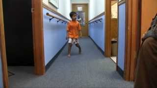 6-year-old boy with swing phase inconsistency | DAFO 3.5 | Cascade Dafo