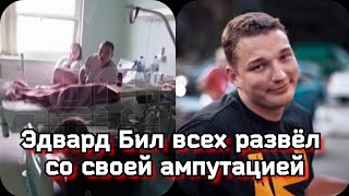 Эдварда Била готовят к выписке | Эдвард Бил всех развёл? | Эдвард Бил нога ампутация новости сегодня