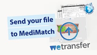 WeTransfer: Send your file to MediMatch