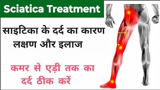 Sciatica Treatment | Sciatica: Pain Symptoms treatment| साइटिका का कारण और इलाज| पैर दर्द| leg pain|