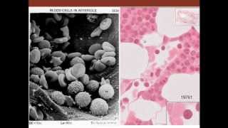 10. Medical School Histology. Peripheral Blood & Hematopoiesis - Part 2 (Hematopoiesis)