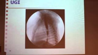 Pediatric GI Obstruction - Malul YEHUDA