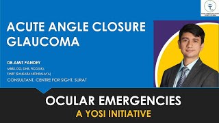 Title: Acute Angle Closure Glaucoma | Dr Amit Pandey | YOSI Ocular Emergency | Episode 2