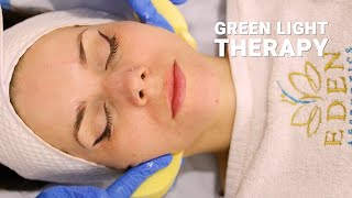 🌿 Discover the Power of Green Light Therapy for Skin Rejuvenation 🌿