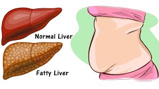 Detox The Liver - Burn Fat Faster