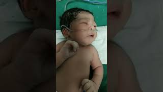 beautiful baby #with cute #plz subcribe##newborn #oxgen baby#trendingshorts #soooo