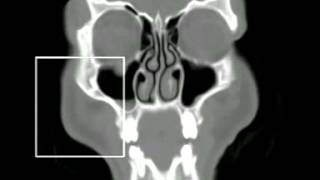 Radiologische Untersuchung des Bereiches Gesicht - Schädel