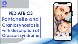 Fontanelle and Craniosynostosis with Description of Crouzon Syndrome @medmiracle952