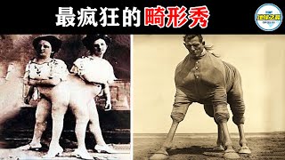 100年前的“畸形秀”有多疯狂？12个历史上真实存在的怪胎，揭秘马戏背后的无奈人生！丨地球之最#冷知识 #排名 #世界之最#畸形秀#猎奇#马戏团#世界之最top#出类拔萃#top10#四足女#骆驼女孩