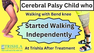 Dystonic Diplegic Cerebral Palsy with Crouch Gait got Excellent Walking Capability after treatment