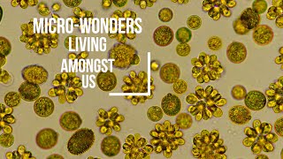 The Amazing World of Microbes