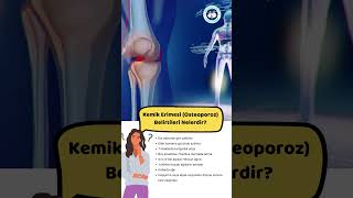 Kemik Erimesi (Osteoporoz) Belirtileri Nelerdir?  #kemik  #belirtiler #kemikerimesi