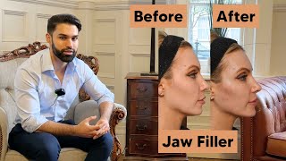 Jaw Filler for that Snatched Jawline