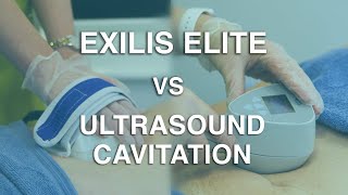 Exilis Elite vs Ultrasound Cavitation| The Body Clinic | Exilis Elite Fat Reduction FAQ 🎯