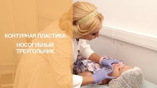 Контурная пластика. Носогубный треугольник