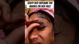 Sexyy Red explains how she got the scars on her face #shorts #celebrity #gossip